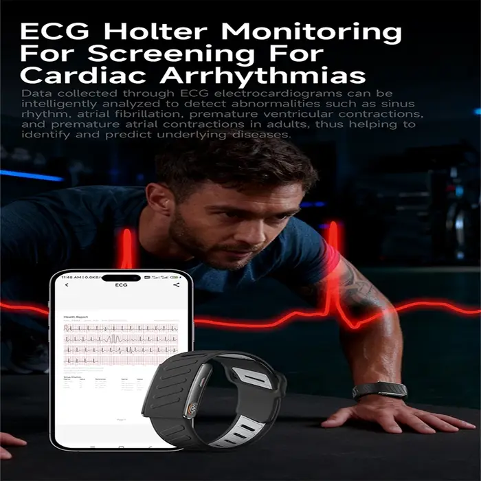Nouvelle Montre Connectée ECG Santé 2026 pour Hommes et Femmes : Analyse de la Composition Sanguine