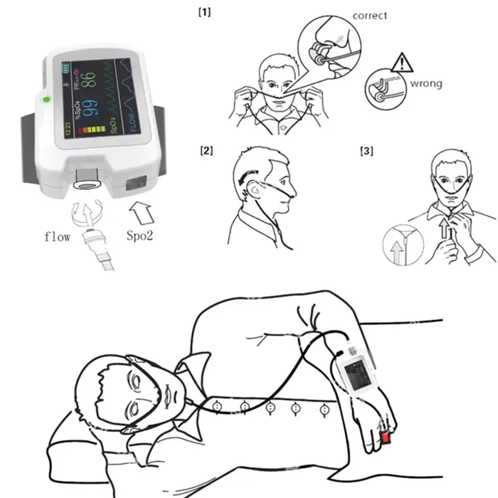 Fissurec RS01-Wrist-watch-Sleep-apnea-screen-meter-Respiration-Sleep-Monitor-PC-SW-CE